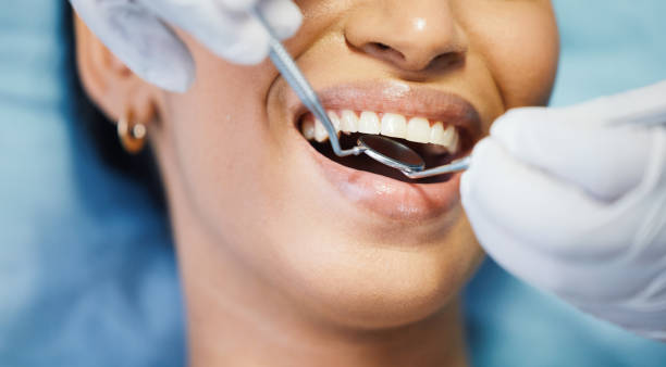Best Emergency Dental Care for Abscessed Tooth in Dawson, TX