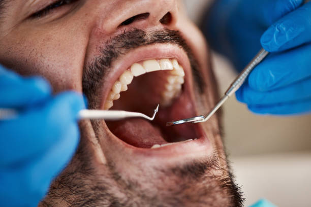 Best Emergency Dentist for Knocked-Out Tooth in Dawson, TX