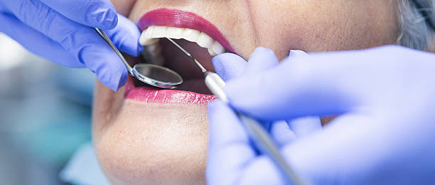 Best Emergency Dental Extractions in Dawson, TX